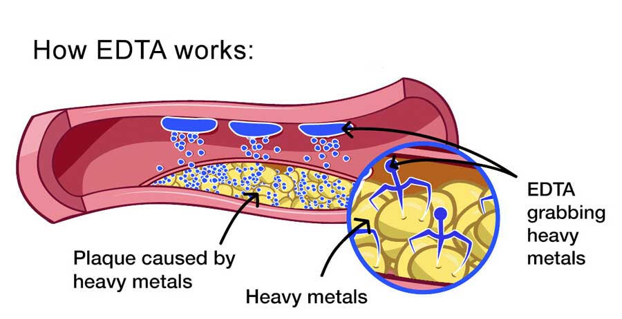 EDTA